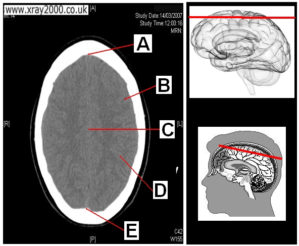 AXIAL SECTION 1.JPG